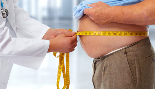 Obesity Management